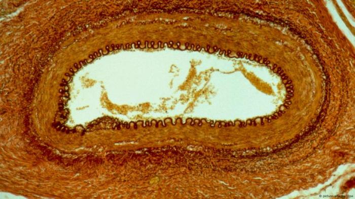 Tiny nanoburrs stick to damaged arteries and repair tissue