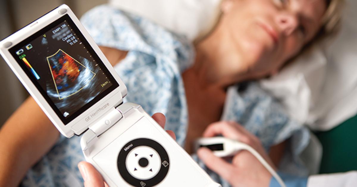 Ultrasound stethoscope replace handheld vscan Will ges handheld ultrasound become the next stethoscope