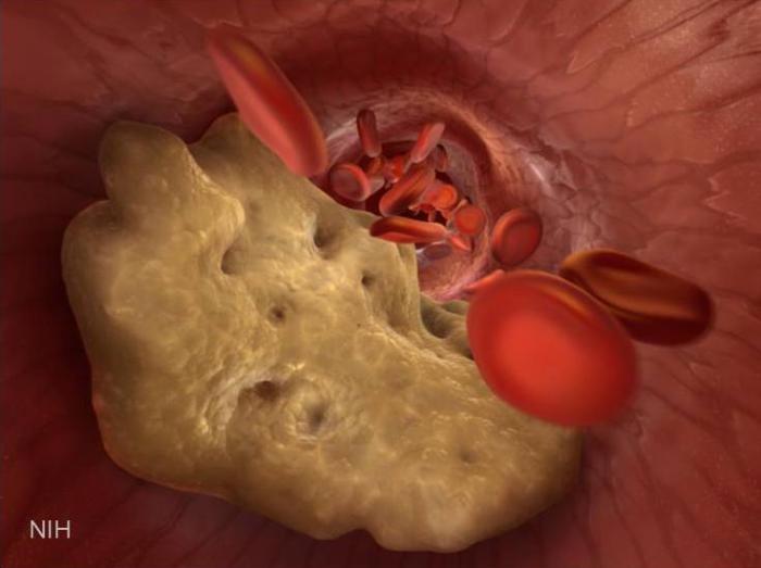 Tiny nanoburrs stick to damaged arteries and repair tissue